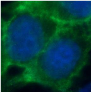 CDH1 Mouse Monoclonal Antibody