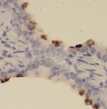 NLRP3 Rabbit Polyclonal Antibody