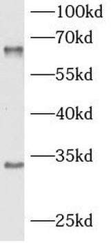 HAVCR2 Antibody