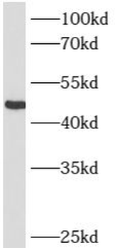 ST6GAL1 Antibody