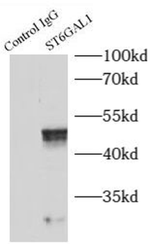 ST6GAL1 Rabbit Polyclonal Antibody