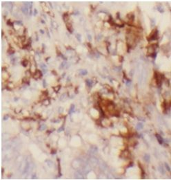 ST6GAL1 Rabbit Polyclonal Antibody