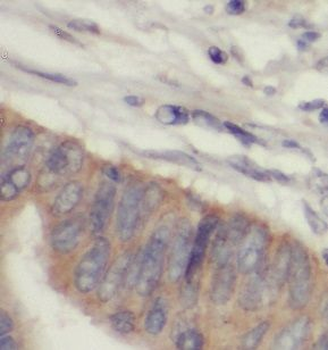 PTPN3 Rabbit Polyclonal Antibody