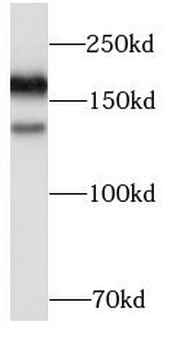 EGFR Mouse Monoclonal Antibody
