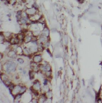 EGFR Mouse Monoclonal Antibody