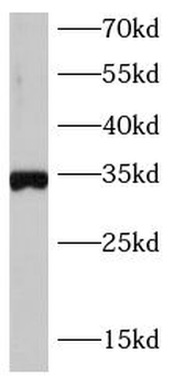 SOX2 Mouse Monoclonal Antibody