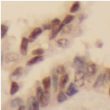 MAP2K7 Rabbit Polyclonal Antibody