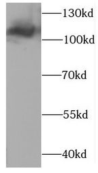 CLCN1 Antibody