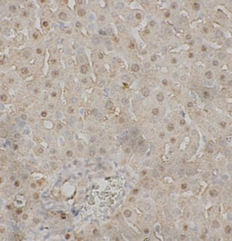 C8B Antibody