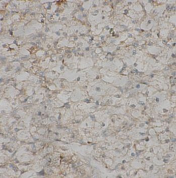 PAX4 Antibody