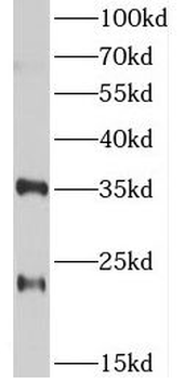 TSPAN12 Antibody