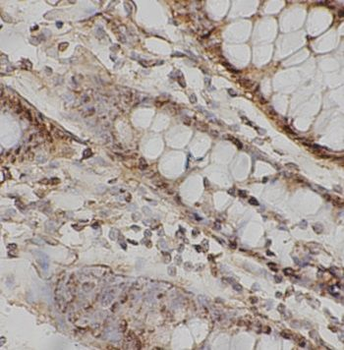 TEC Rabbit Polyclonal Antibody