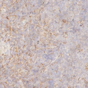 ETV6 Rabbit Polyclonal Antibody
