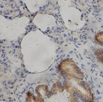 SLA Rabbit Polyclonal Antibody