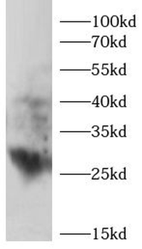 SFRP2 Rabbit Polyclonal Antibody