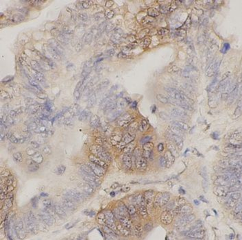 SFRP2 Rabbit Polyclonal Antibody