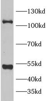 IDE Rabbit Polyclonal Antibody