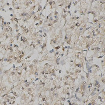 IDE Rabbit Polyclonal Antibody
