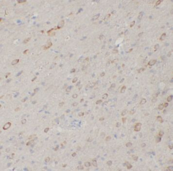 SFTPB Antibody