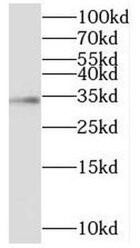 IGFBP2 Antibody