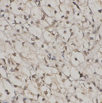 IGFBP2 Rabbit Polyclonal Antibody
