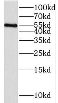 IRAK4 Antibody