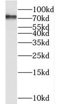 RIPK1 Antibody