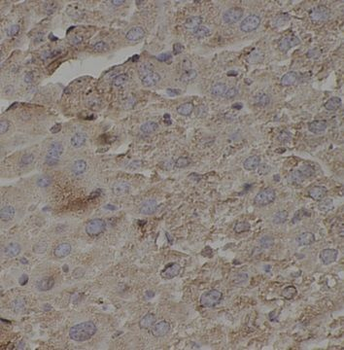 RIPK1 Rabbit Polyclonal Antibody