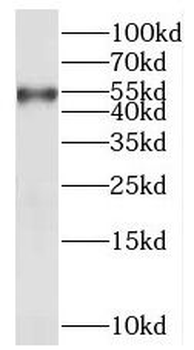 AKT1 Rabbit Polyclonal Antibody
