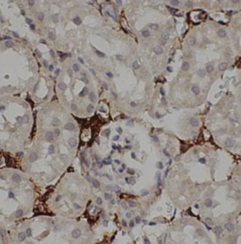 AKT1 Rabbit Polyclonal Antibody