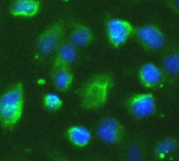 IRAK2 Antibody