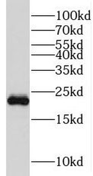 KRAS Rabbit Polyclonal Antibody
