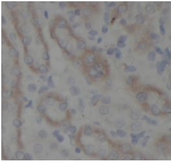 KRAS Rabbit Polyclonal Antibody