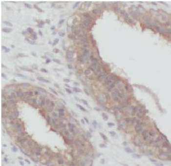 FOXO3 Rabbit Polyclonal Antibody