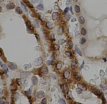 MAVS Rabbit Polyclonal Antibody