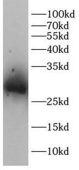 GCLM Rabbit Polyclonal Antibody