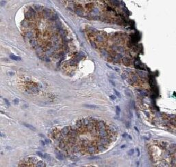 HRAS Rabbit Polyclonal Antibody