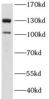 IRS1 Rabbit Polyclonal Antibody