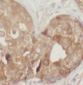 IRS1 Rabbit Polyclonal Antibody