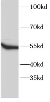FYN Rabbit Polyclonal Antibody
