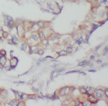 FYN Rabbit Polyclonal Antibody