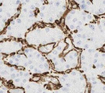 ABCB11 Antibody
