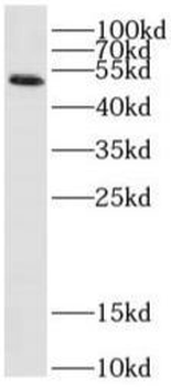 SARS-CoV-2 N protein Antibody