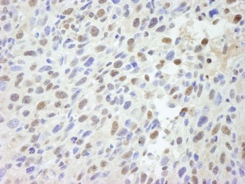Rabbit anti-MED12 IHC Antibody