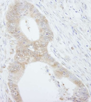 Rabbit anti-4EBP1 IHC Antibody