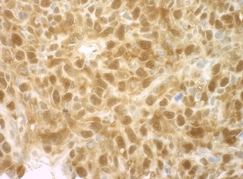 Rabbit anti-4EBP1 IHC Antibody