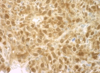 4EBP1 Antibody