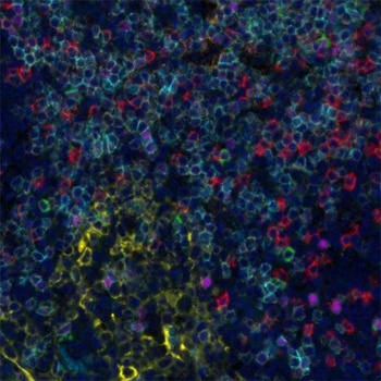 CD3E, Cytokeratin, CD8 alpha, CD4, LAG3, FOXP3 Antibody