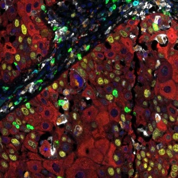 Activated T Cell PathPlex Panel (CD3E, Cytokeratin, CD8 alpha, CD68, Ki-67, PD-L1)