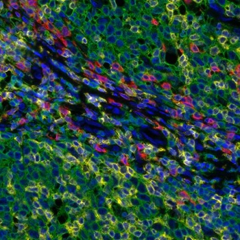 Tumor Infiltrating Lymphocyte (TIL) Antibody Panel